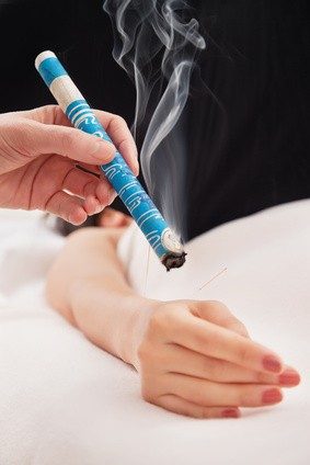 Bâton de moxa chauffant un point d’acupuncture sur l’avant-bras