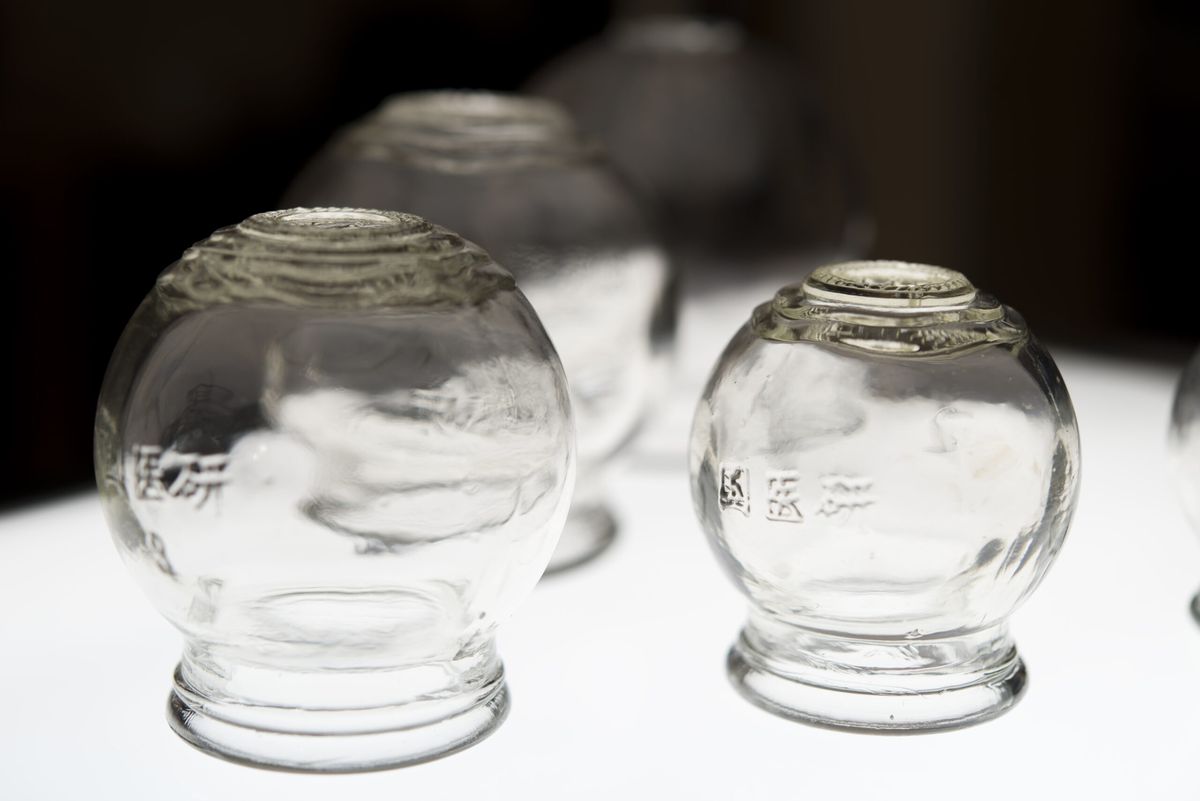 Ventouses chinoises traditionnelles en verre utilisées au cabinet